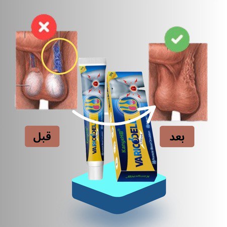 كريم علاج دوالي الخصية